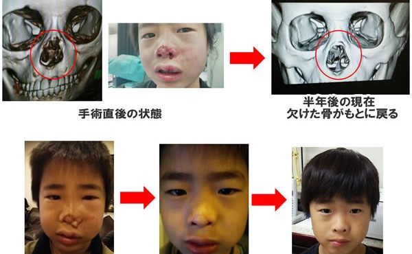 必見 証拠写真 Drtの脅威の治癒力パワーをご覧下さい 日本drt協会